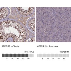 ATF7IP2 Antibody, Novus Biologicals 25 &mu;L, Unlabeled:Antibodies, Polyclonal